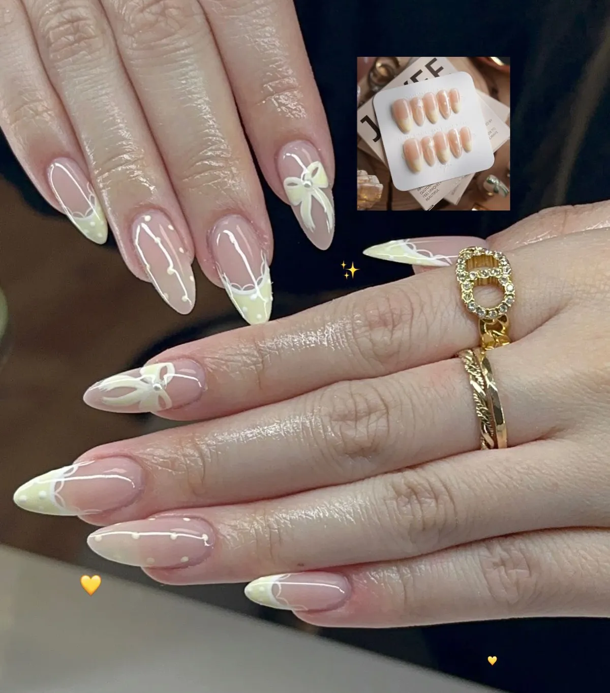 Baby Yellow Tips with White Scallop Lines and Bow Accent