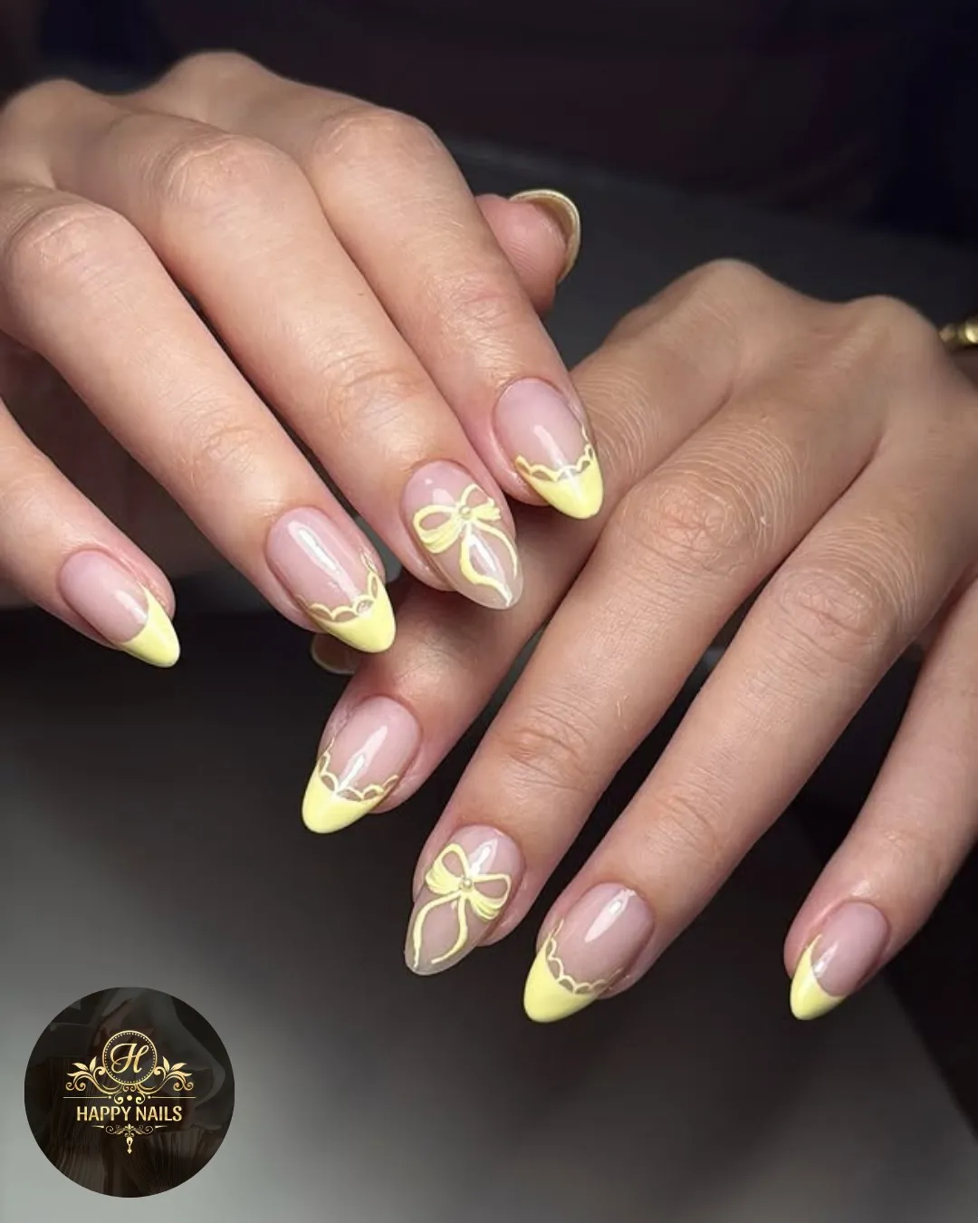 Scalloped Yellow French Tips with Bow Accents